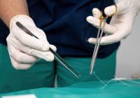 Maîtriser l’utilisation des sets de sutures en médecine d’urgence