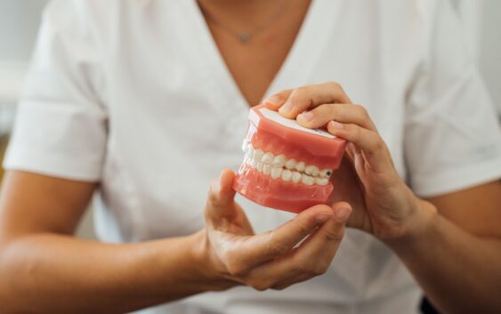 Partial view of a nurse holding dentures in hands