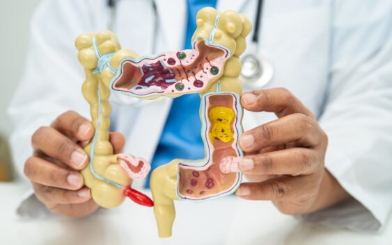 Intestine, appendix and digestive system, doctor holding anatomy model for study diagnosis