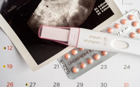 Pregnancy test and birth control pills with ultrasound scan of baby uterus, contraception health.