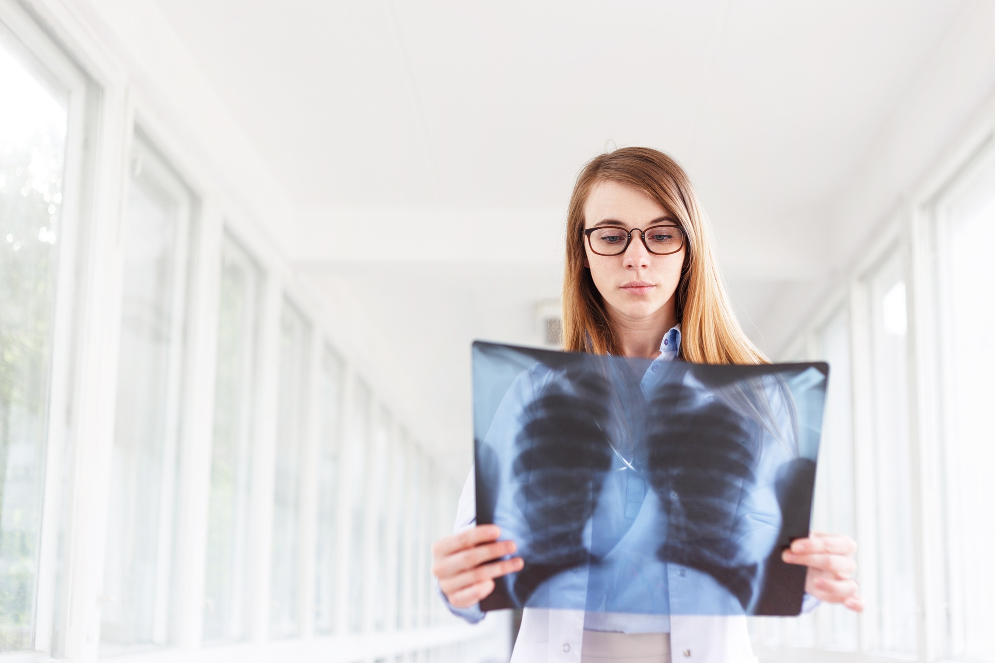 Confident female doctor examining accurately a rib cage x-ray.