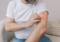 Le zona peut-il cacher un cancer : mythes et réalités révélés Le zona peut-il cacher un cancer : mythes et réalités révélés