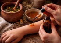 Utiliser la teinture d’iode et remède de grand-mère pour une guérison rapide et efficace Utiliser la teinture d’iode et remède de grand-mère pour une guérison rapide et efficace