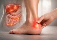 Les symptômes de l’épine calcanéenne et foie intestin que vous ne devez pas ignorer Les symptômes de l’épine calcanéenne et foie intestin que vous ne devez pas ignorer