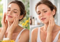 Peut-on mettre de l’arnica sur le visage : les avantages et les inconvénients Peut-on mettre de l’arnica sur le visage : les avantages et les inconvénients